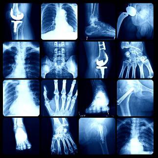 1234 Заботьтесь о здоровье: новая кампания «Здоровая кожа – здоровые суставы» в Курской области 1234 Заботьтесь о здоровье: новая кампания «Здоровая кожа – здоровые суставы» в Курской области