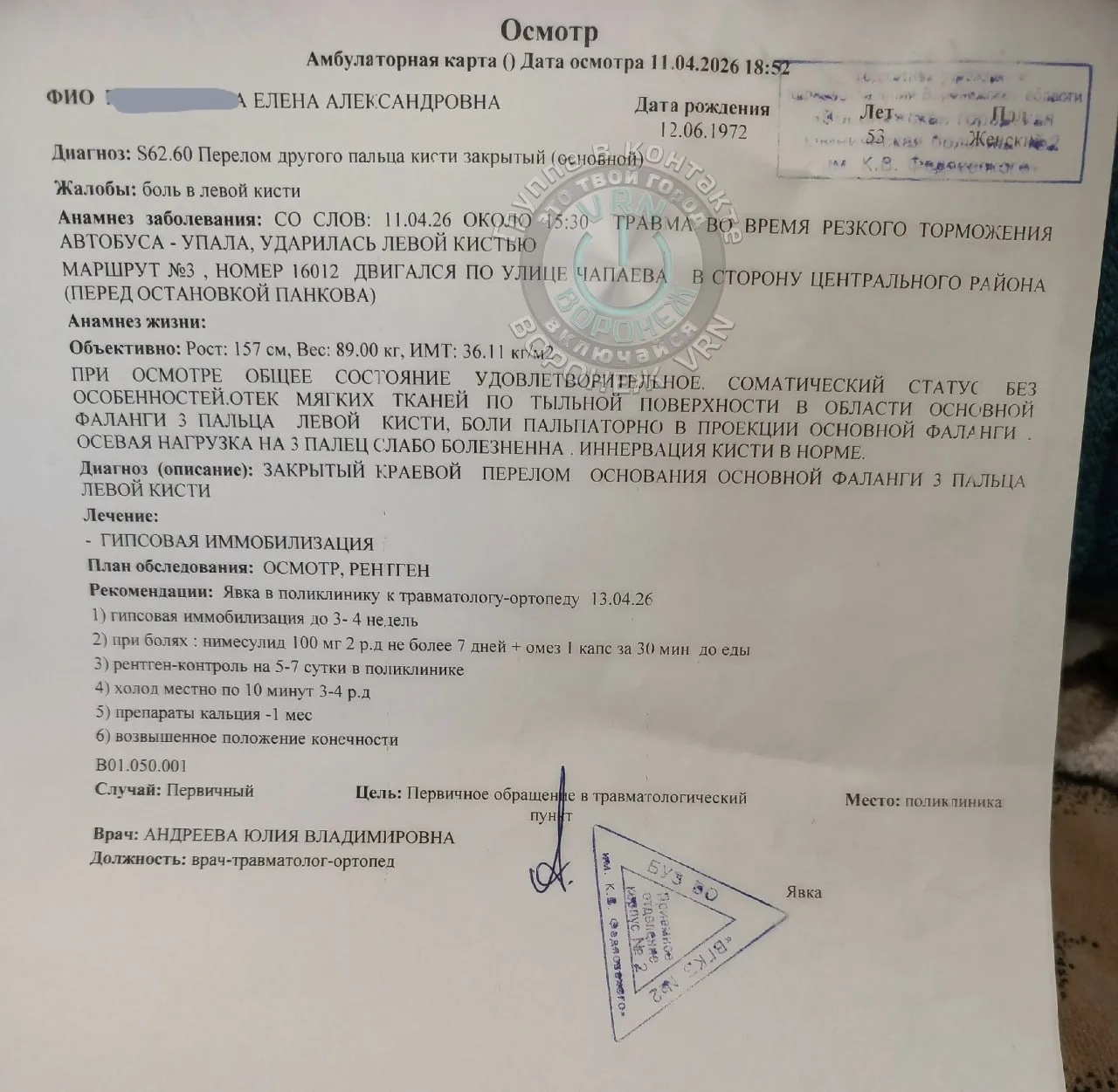 В Воронеже женщина с маленьким внуком упала из-за резко затормозившего автобуса и сломала палец