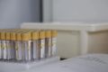 Куряне заболели острой кишечной инфекцией от покупных оливье и окрошки